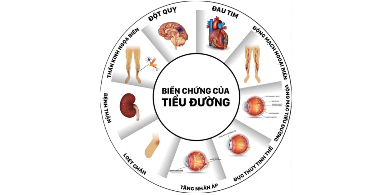 Spirulina tươi hỗ trợ quản lý bệnh  tiểu đường như thế nào ?